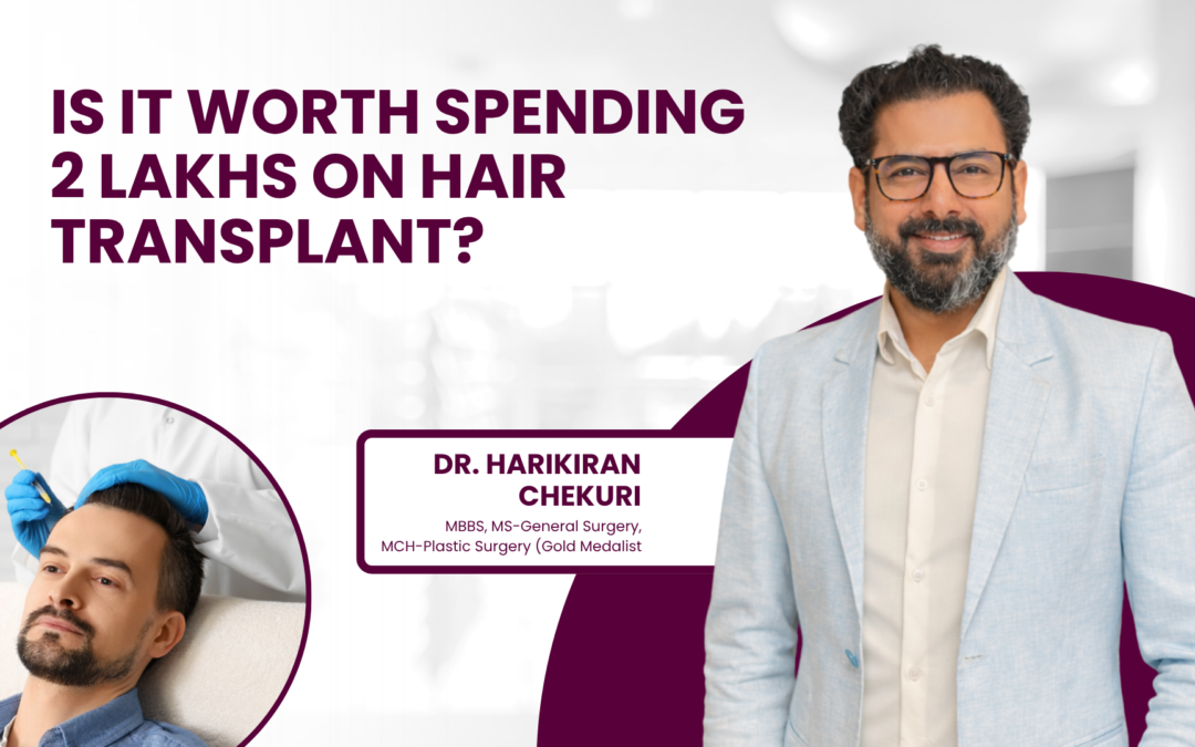 Is It Worth Spending 2 Lakhs on Hair Transplant?