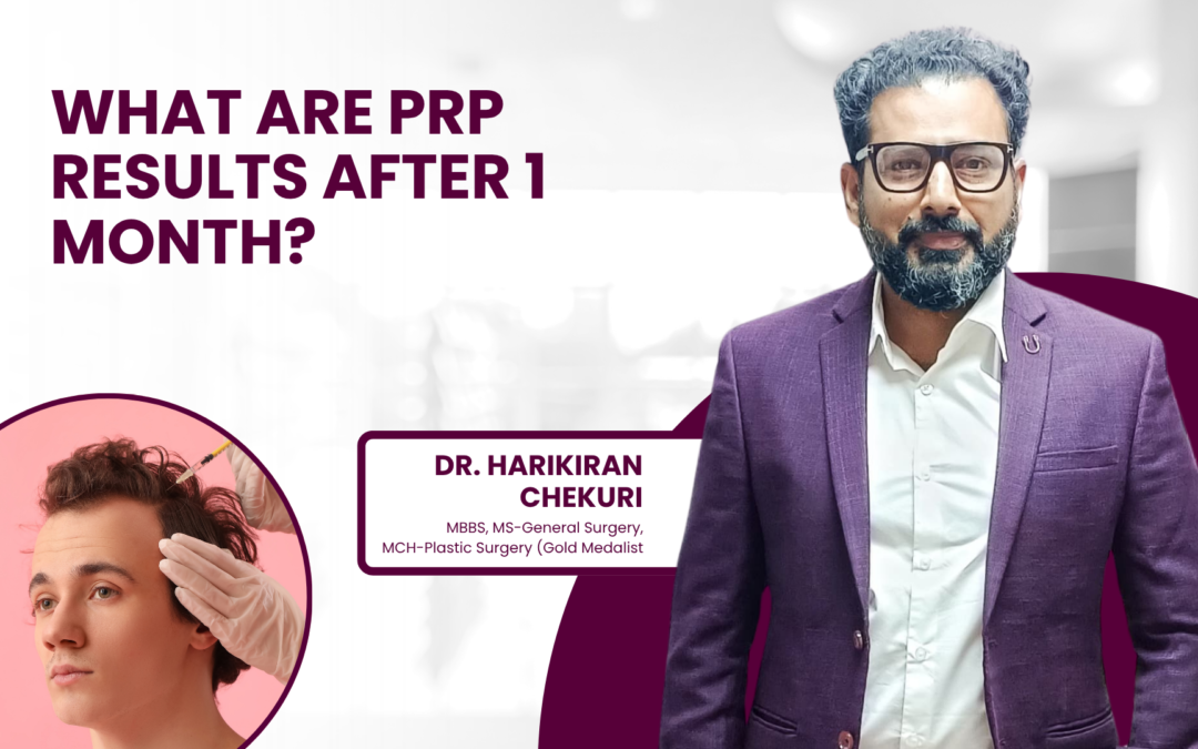 What Are PRP Results After 1 Month?