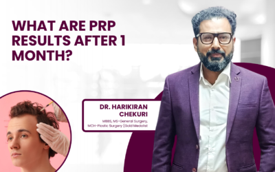 What Are PRP Results After 1 Month?