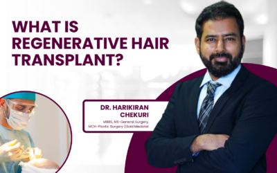 What Is Regenerative Hair Transplant?