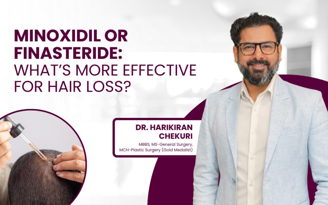 Minoxidil vs Finasteride: Which One Actually Works Better for Hair Loss