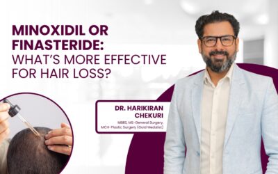 Minoxidil vs Finasteride: Which One Actually Works Better for Hair Loss