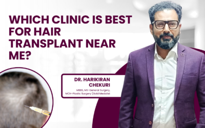 Which Clinic Is Best for Hair Transplant Near Me?