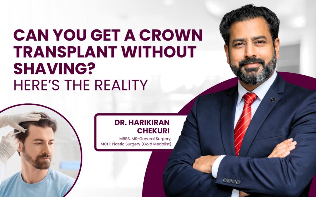Crown Hair Transplant Without Shaving Head