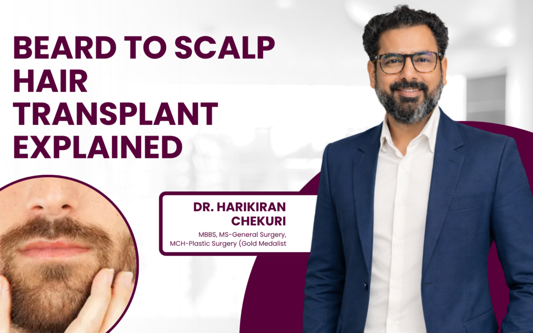 Beard to Scalp Hair Transplant Explained