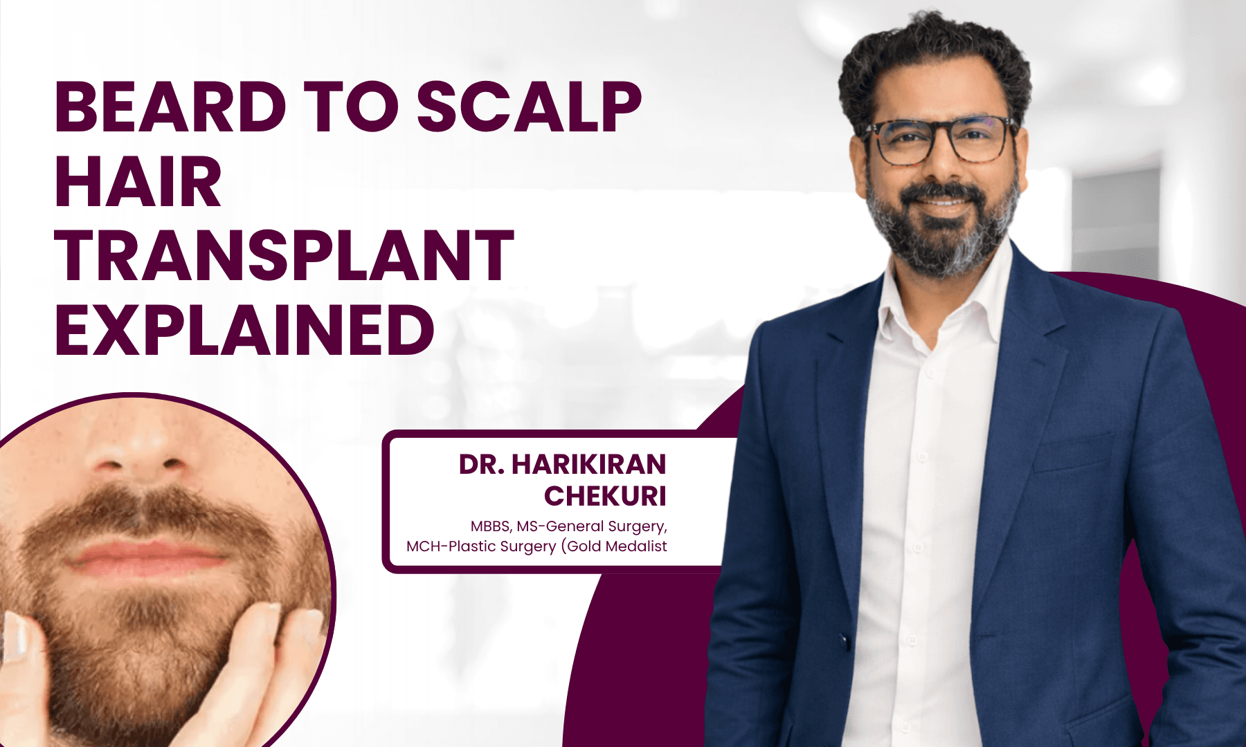 Beard to Scalp Hair Transplant Explained | Redefine Best Vitiligo Treatment Options in India - Dr. Harikiran Chekuri