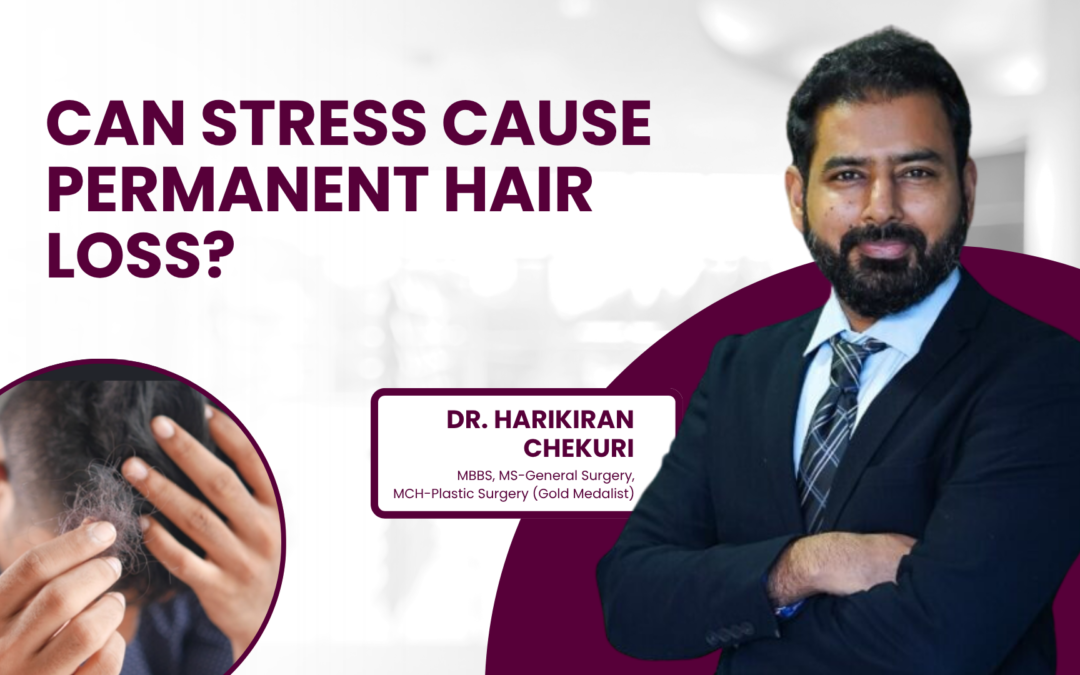 Can Stress Cause Permanent Hair Loss?