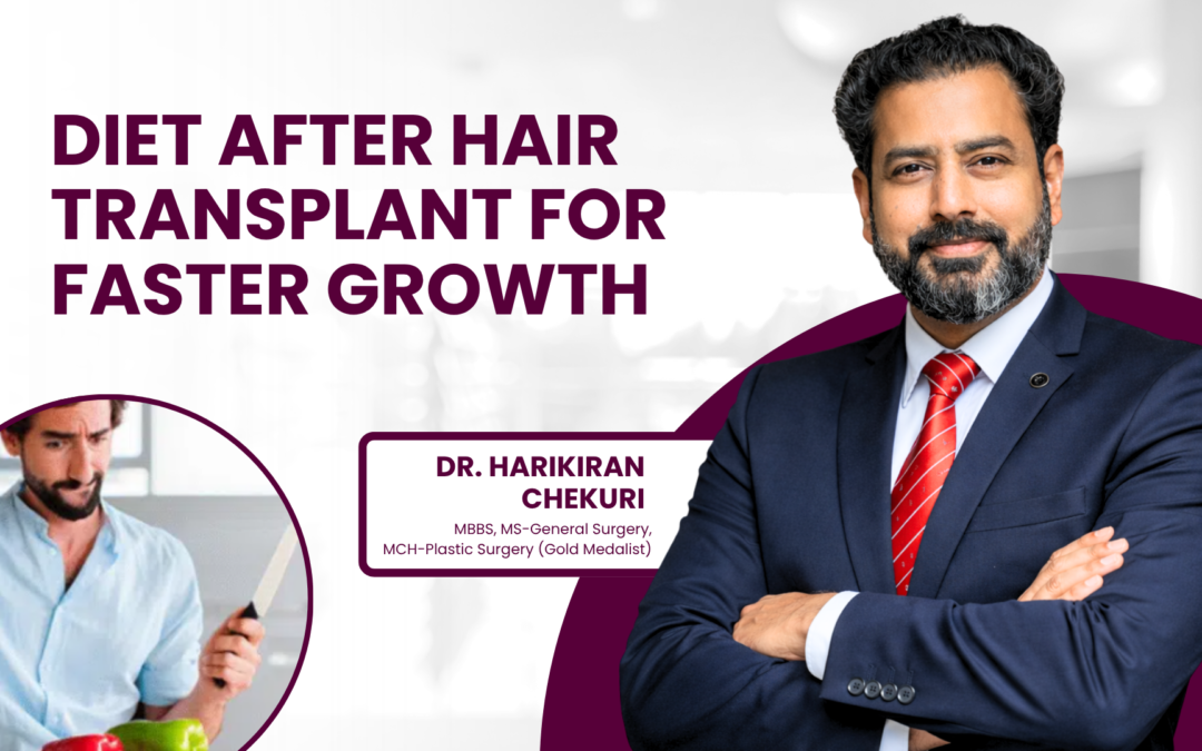 Diet After Hair Transplant for Faster Growth