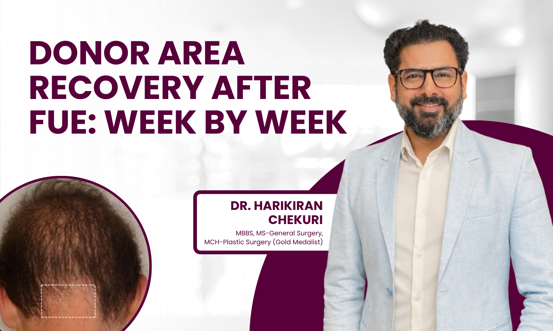 Banner promoting donor area recovery after FUE: Week by week, featuring Dr. Harikiran Chekuri with a man in a light blue blazer on a white backdrop and maroon accents.