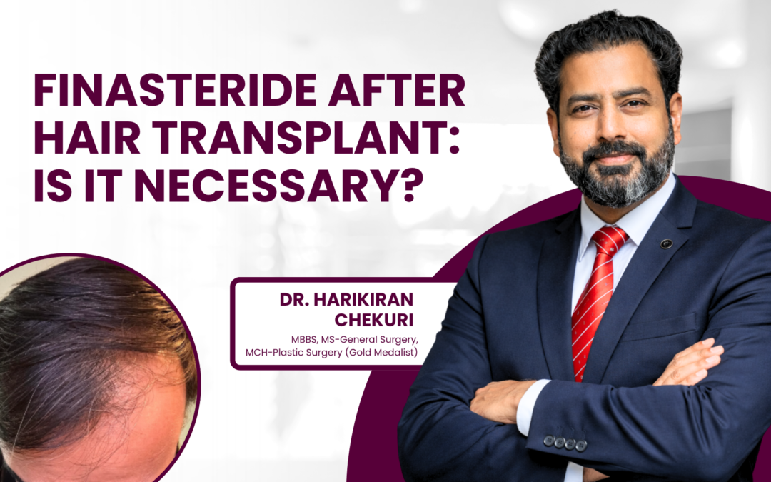 Finasteride After Hair Transplant: Is It Necessary?