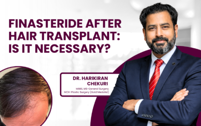 Finasteride After Hair Transplant: Is It Necessary?