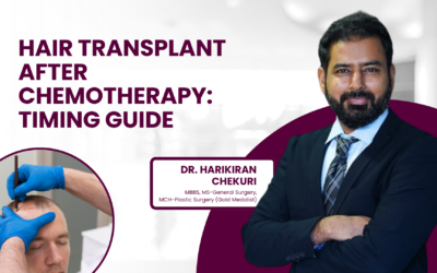 Hair Transplant After Chemotherapy: Timing Guide