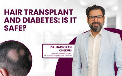 Hair Transplant and Diabetes: Is It Safe?