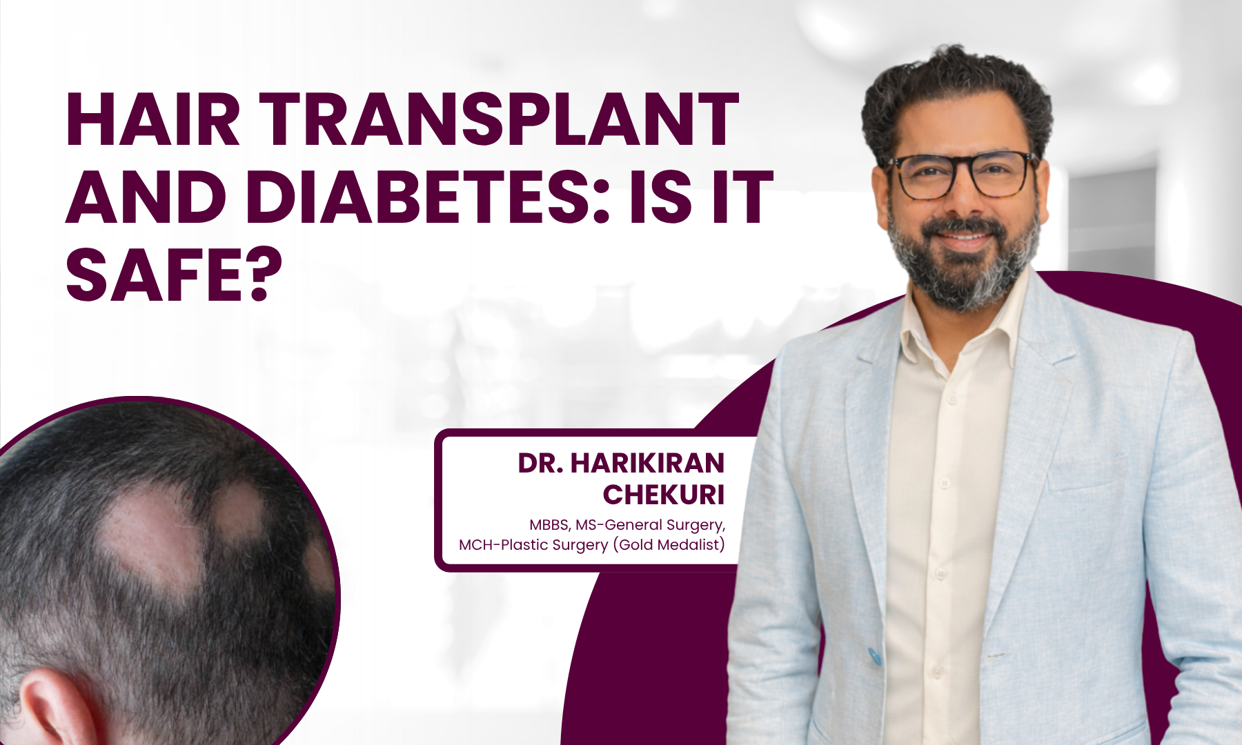 Banner about hair transplant safety for diabetics, showing a man in a light blazer on the right and bold title text on the left.