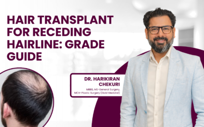 Hair Transplant for Receding Hairline: Grade Guide