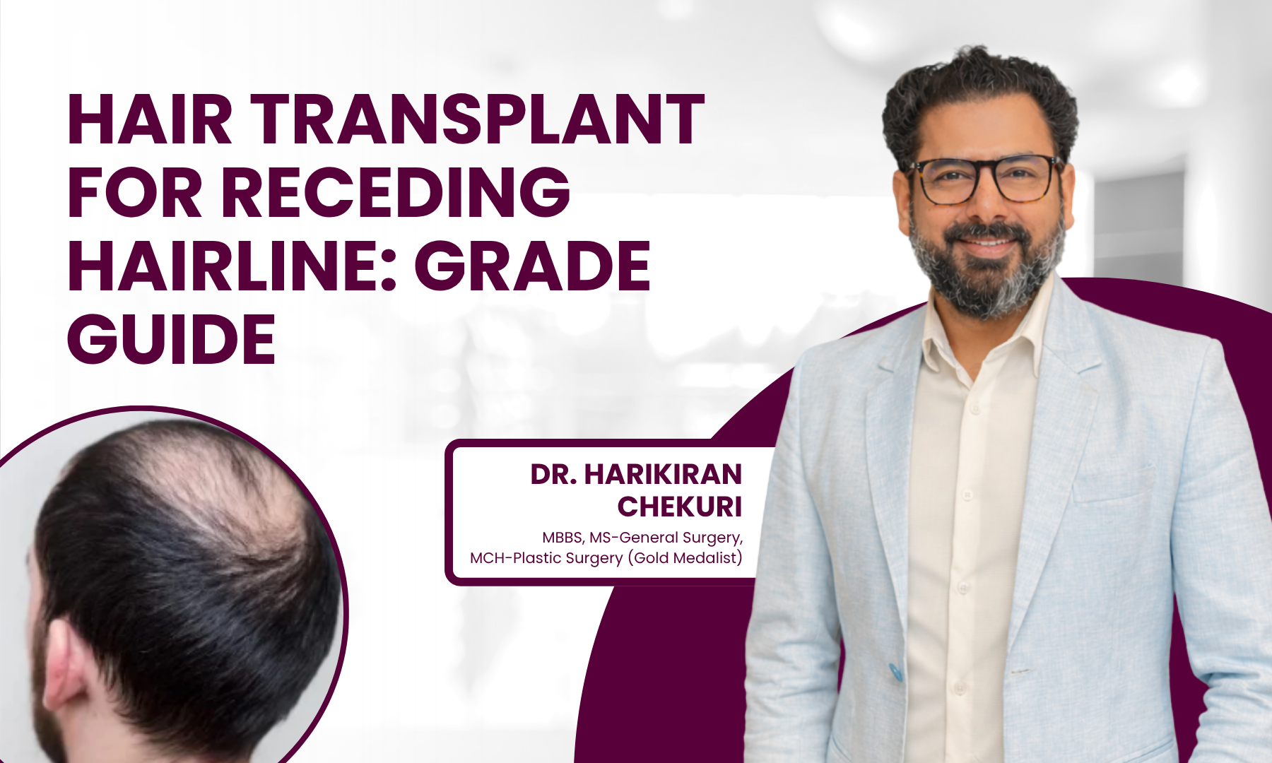 Promotional banner about a hair transplant grade guide with Dr. Harikiran Chekuri on the right and a scalp image on the left.