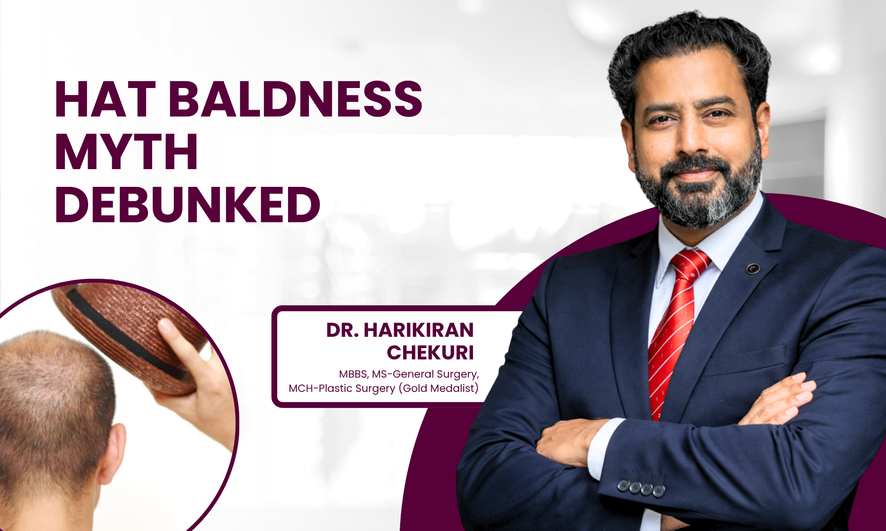 Banner promoting baldness myth debunking with a confident doctor on the right and circular baldness image on the left; headline reads 'Hat Baldness Myth Debunked'