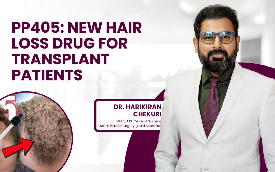 PP405: New Hair Loss Drug for Transplant Patients