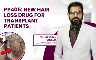 PP405: New Hair Loss Drug for Transplant Patients