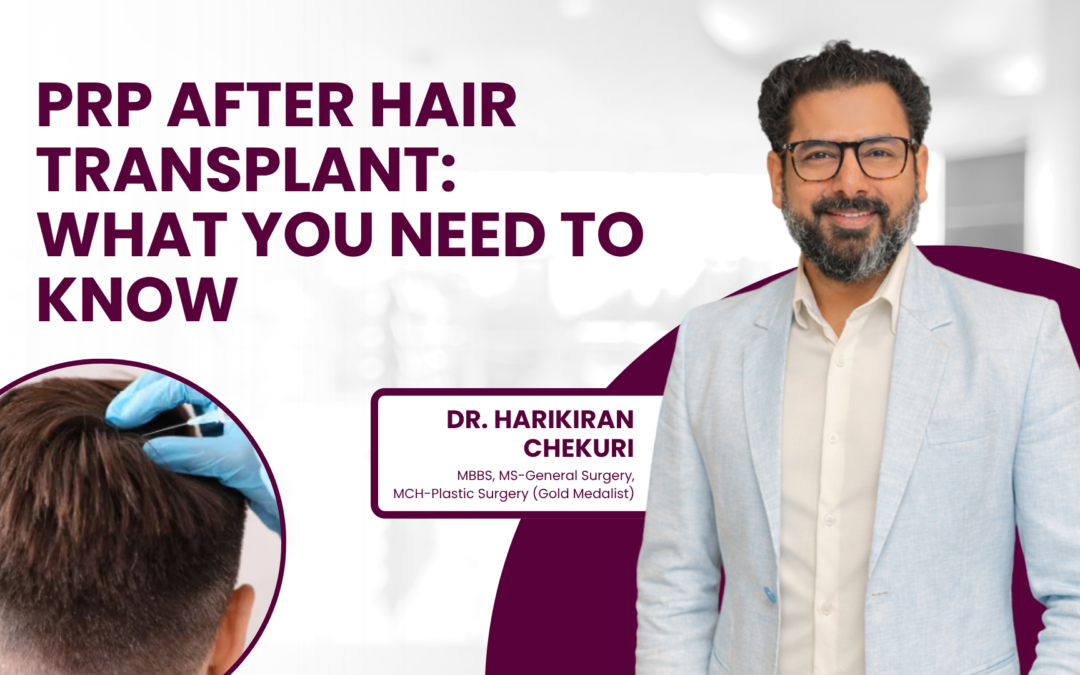 PRP After Hair Transplant: What You Need to Know