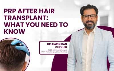 PRP After Hair Transplant: What You Need to Know