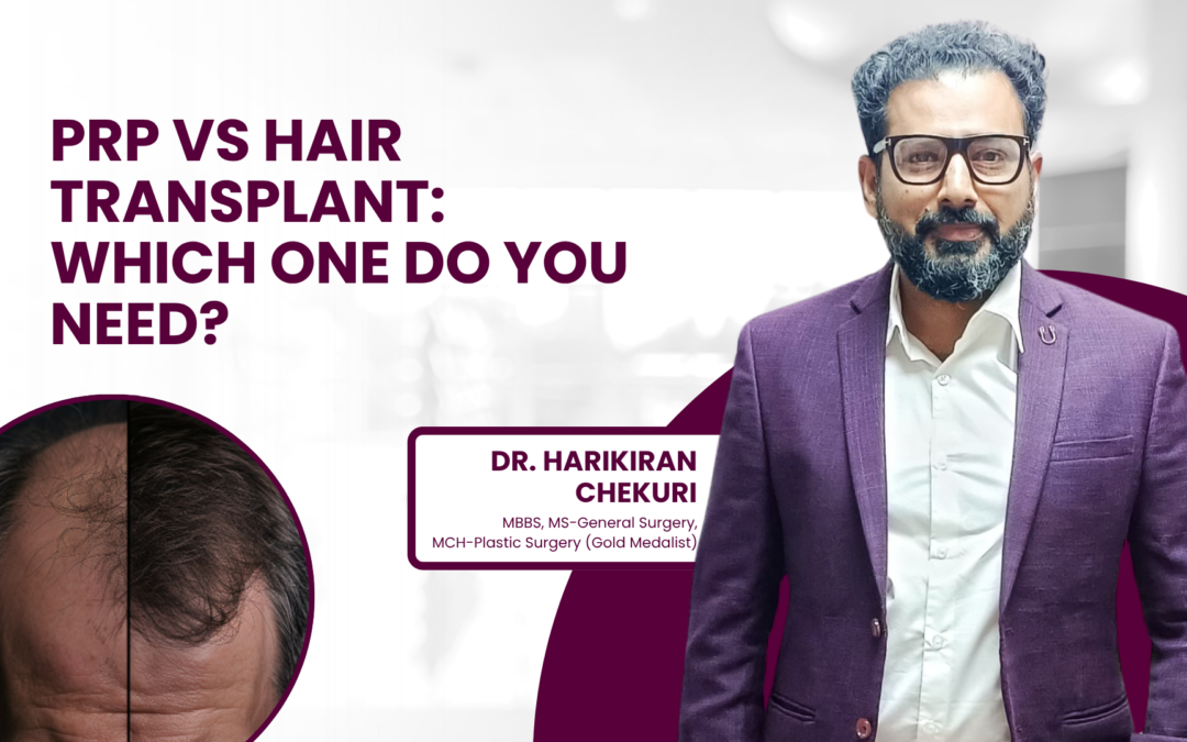 PRP vs Hair Transplant: Which One Do You Need?