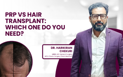 PRP vs Hair Transplant: Which One Do You Need?