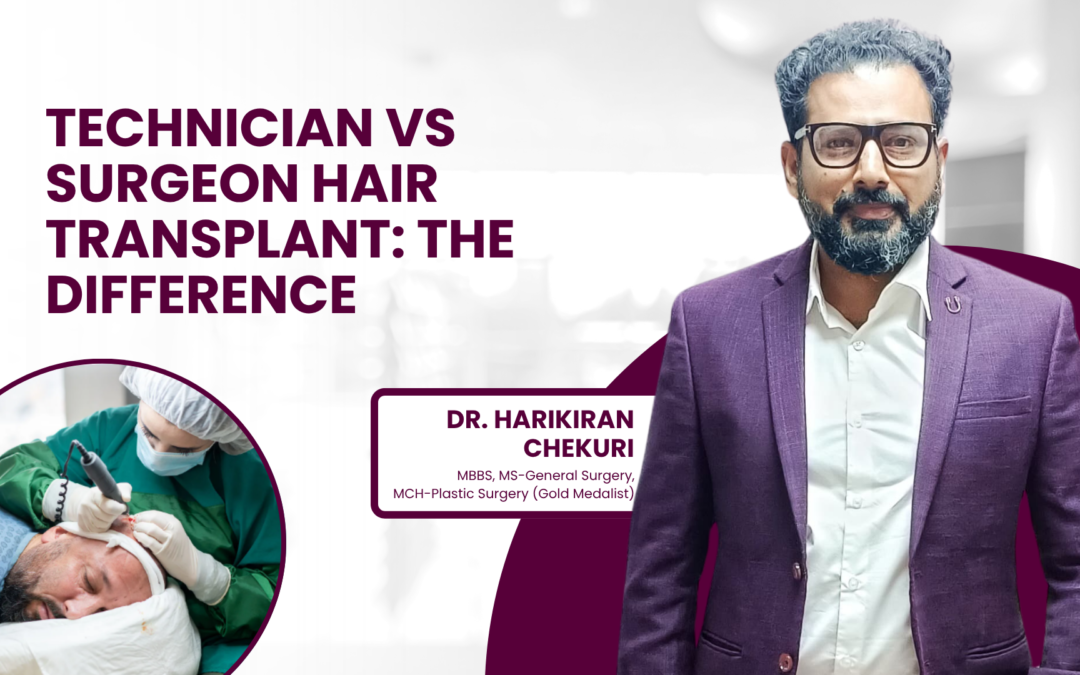 Technician vs Surgeon Hair Transplant: The Difference