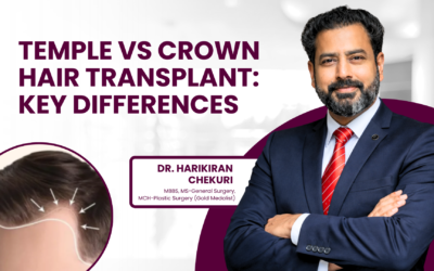 Temple vs Crown Hair Transplant: Key Differences