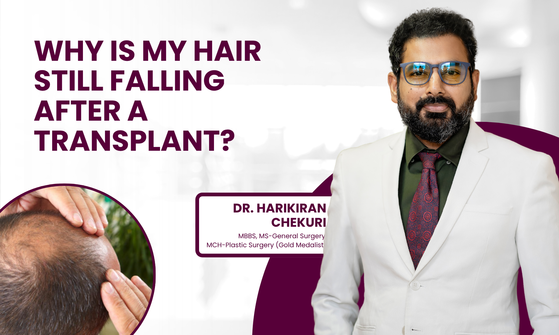 Banner showing Dr. Harikiran Chekuri in a white suit with bold maroon text about hair loss after a transplant; left circular image of a patient touching scalp.