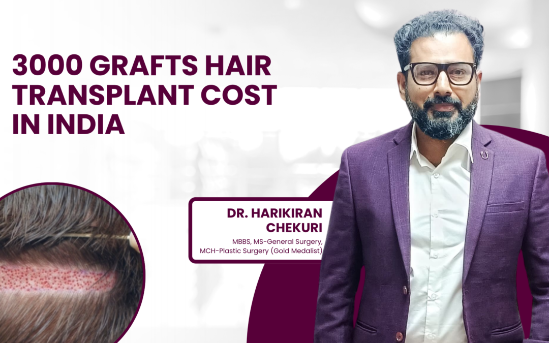 3000 Grafts Hair Transplant Cost in India