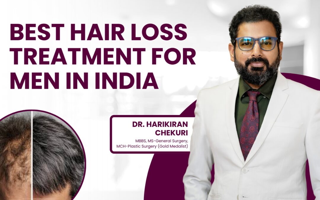 Best Hair Loss Treatment for Men in India?