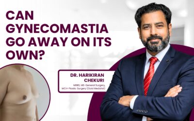 Can Gynecomastia Go Away on Its Own?