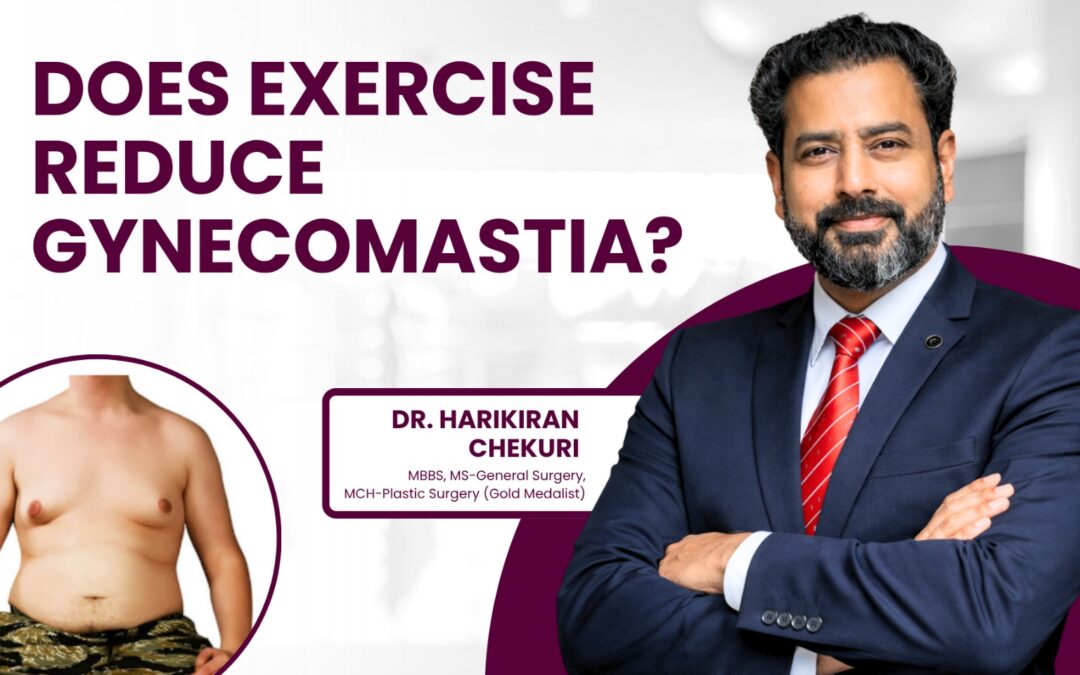 Does Exercise Reduce Gynecomastia?