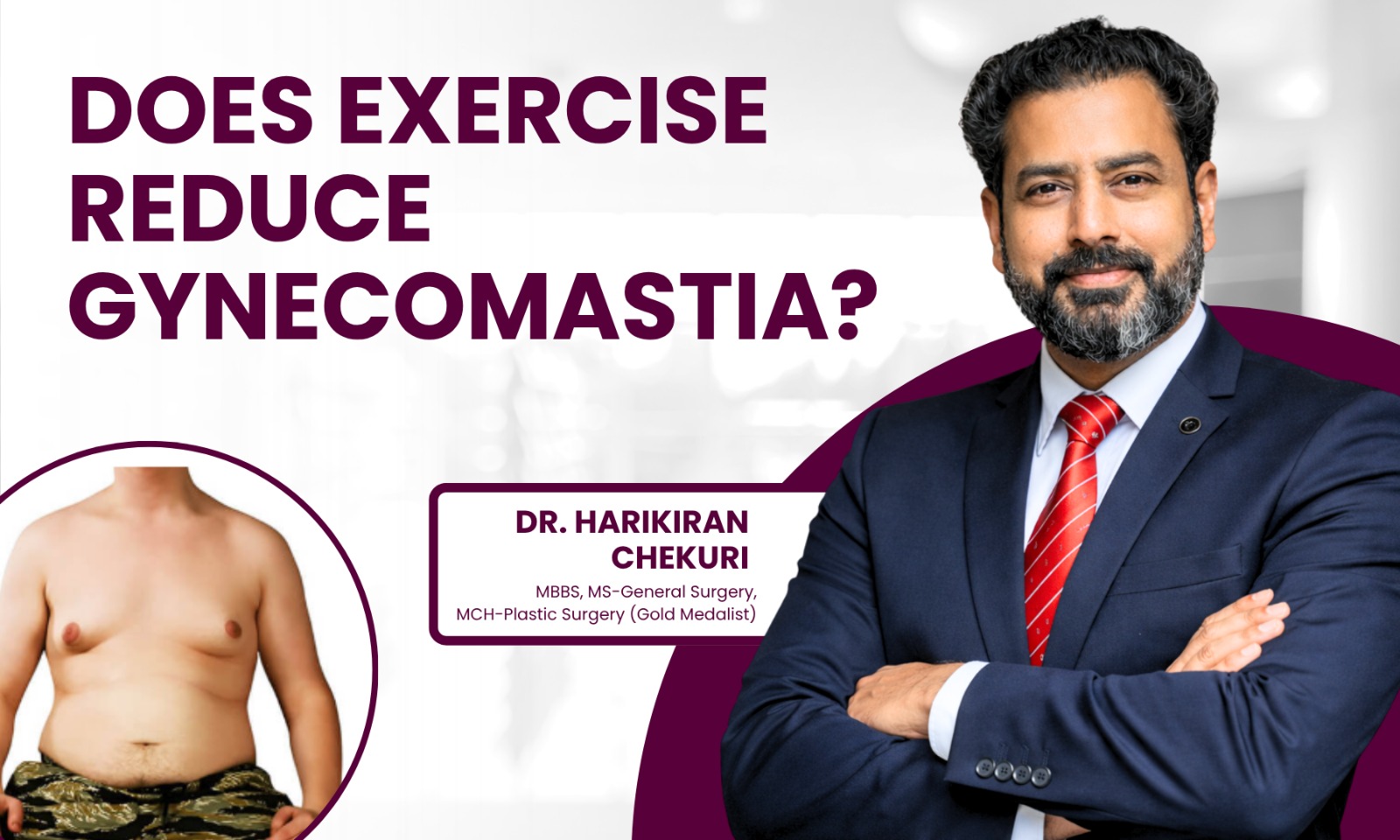 Does Exercise Reduce Gynecomastia - Dr. Harikiran Chekuri