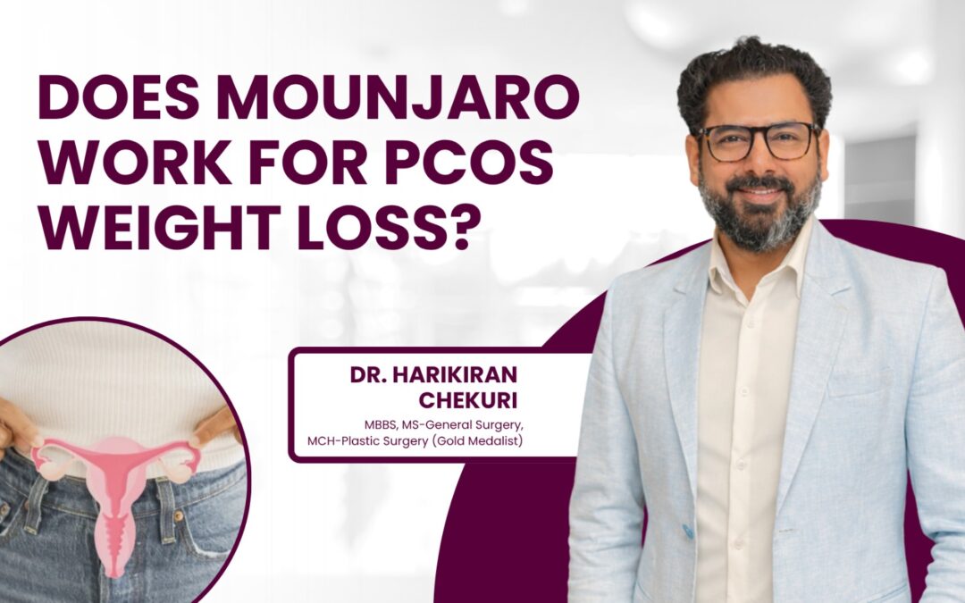 Does Mounjaro Work for PCOS Weight Loss?