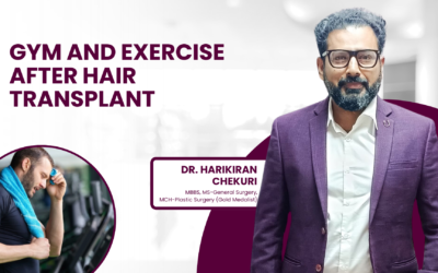 Gym and Exercise After Hair Transplant