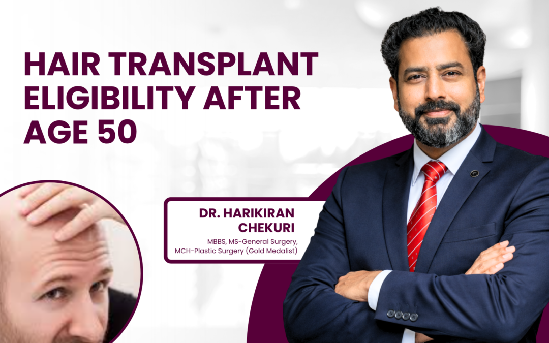 Hair Transplant Eligibility After Age 50