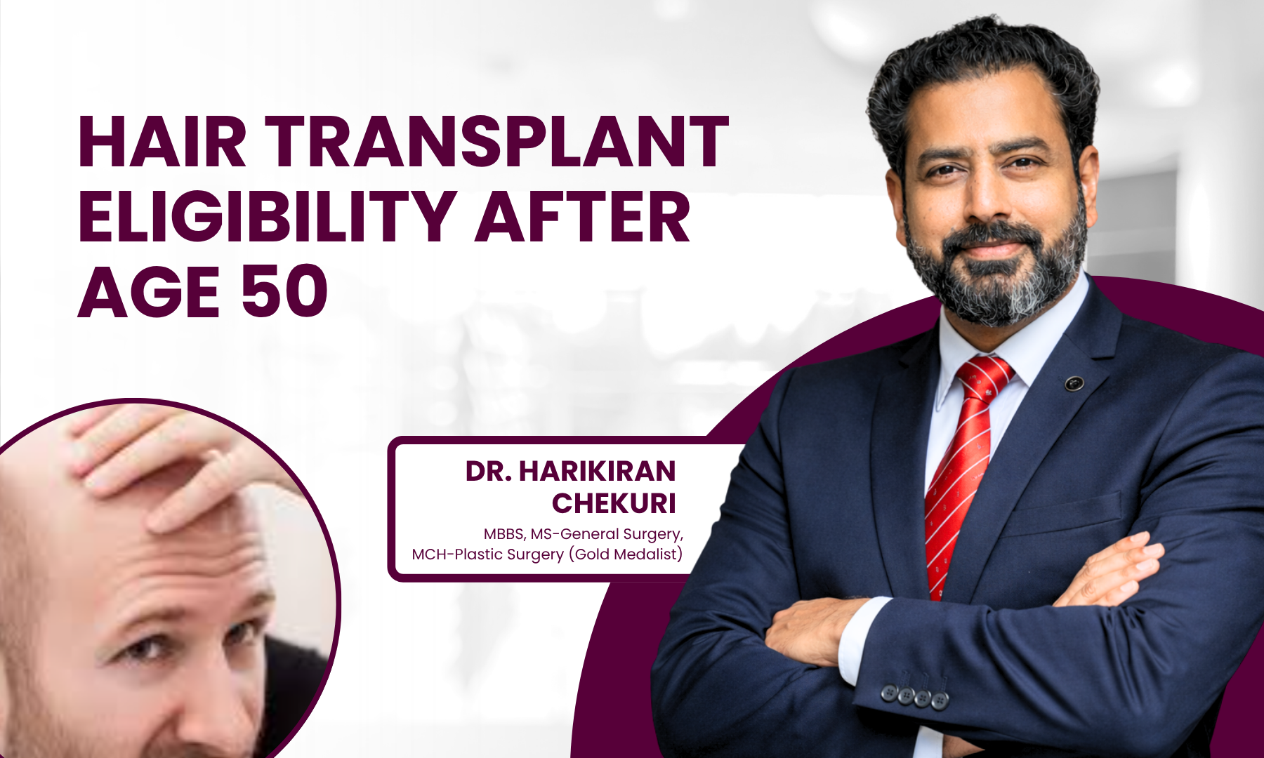 Banner: bold headline 'Hair Transplant Eligibility After Age 50' with a smiling doctor on the right and a circular image of a patient's scalp on the left.