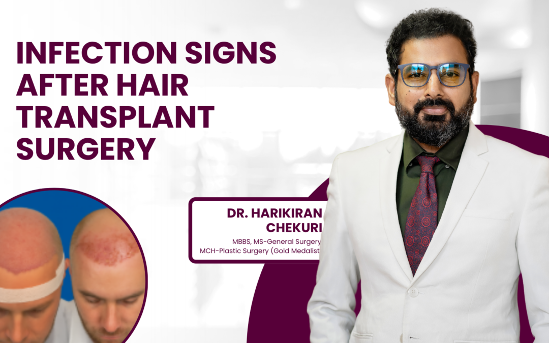 Infection Signs After Hair Transplant Surgery