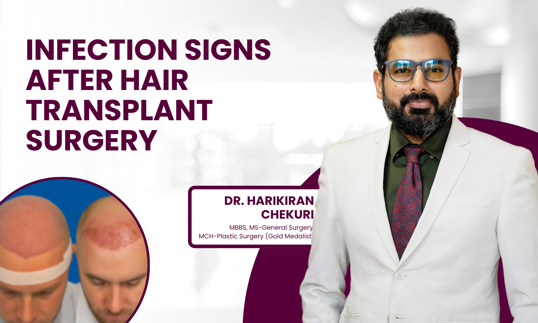 Banner about infection signs after hair transplant surgery, featuring a doctor in a white coat and a circular scalp photo on the left.