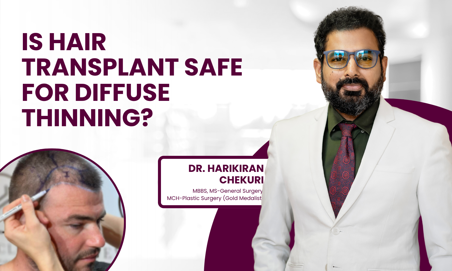Promotional banner featuring a doctor in a white suit and bold text asking if hair transplant is safe for diffuse thinning, with a patient image in a circle on the left.