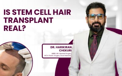 Is Stem Cell Hair Transplant Real?