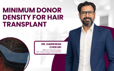 Minimum Donor Density for Hair Transplant