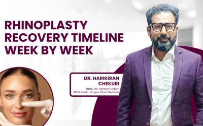 Rhinoplasty Recovery Timeline Week by Week