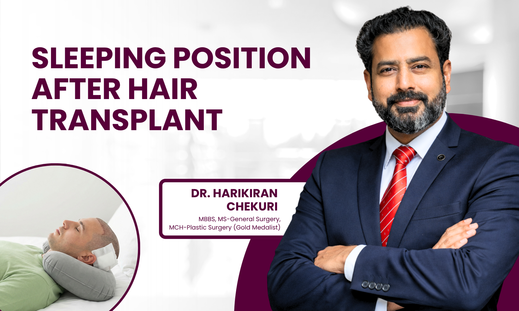 Banner promoting 'Sleeping Position After Hair Transplant' with a smiling doctor in a dark suit on the right and a sleeping patient in a circular frame on the left, maroon accents. For a clinic promo image, conveys the topic and care context.
