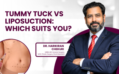Tummy Tuck vs Liposuction: Which Suits You?