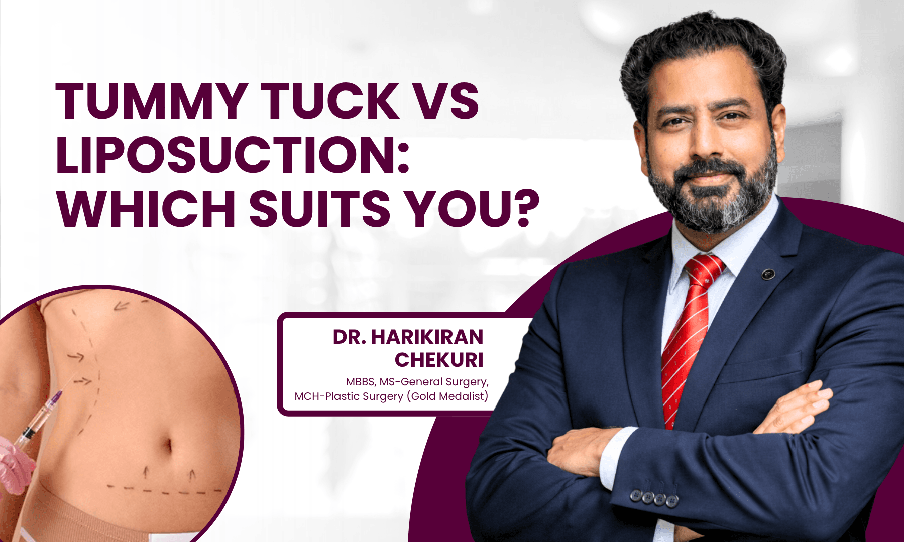 Tummy Tuck vs Liposuction - Dr Harikiran Chekuri