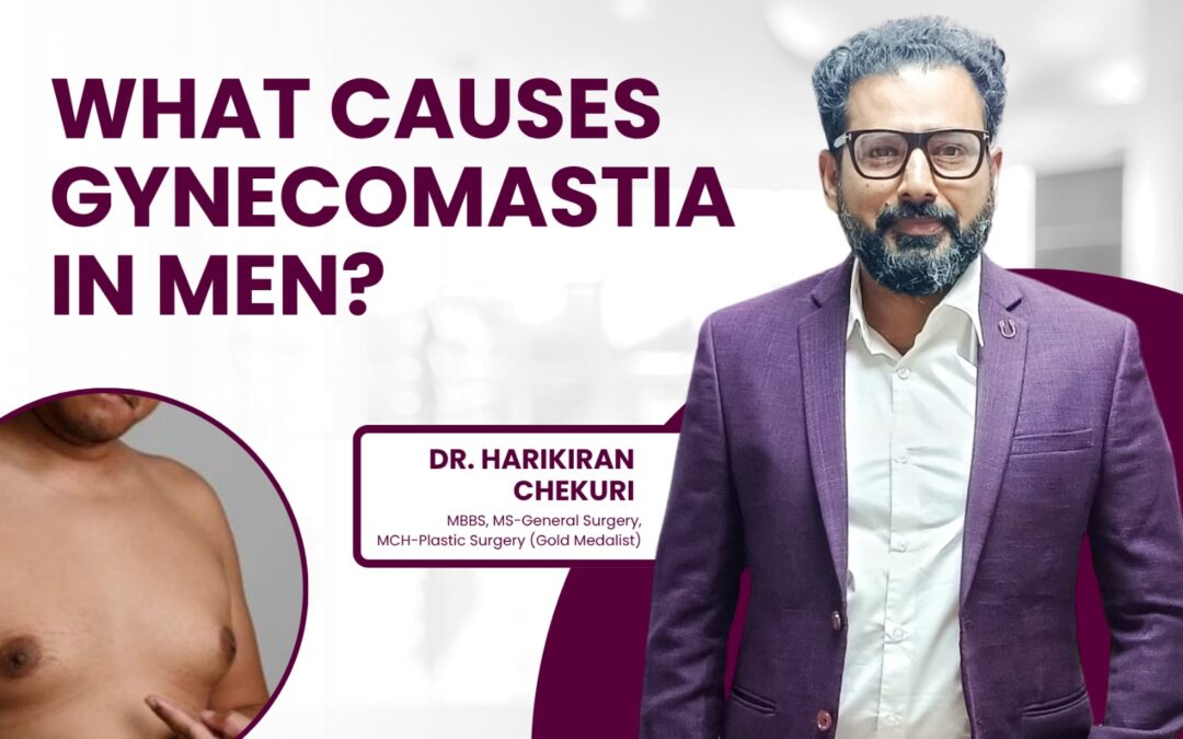 What Causes Gynecomastia in Men?