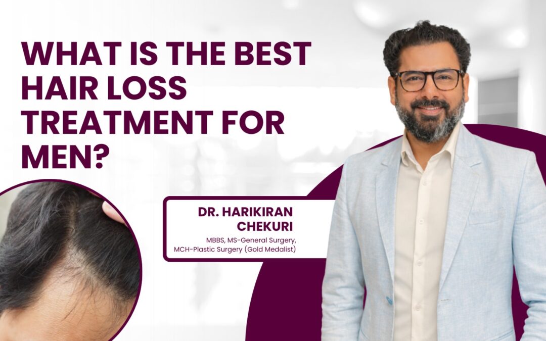 What Is the Best Hair Loss Treatment for Men?